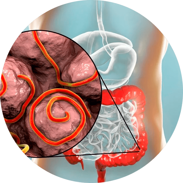 Gastrointestinální trakt a paraziti